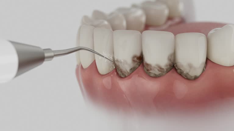 Trusted Wisdom Tooth Removal service in Gaylord, MI - Dentist Open Now